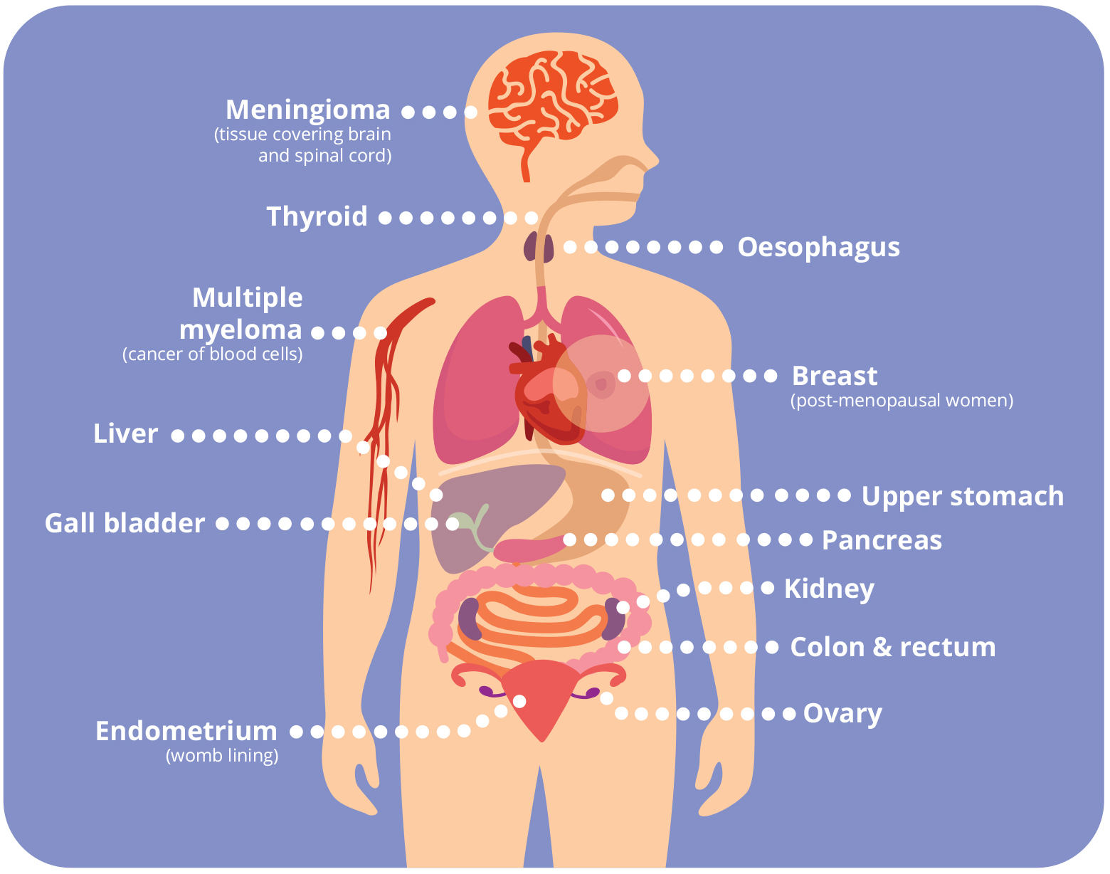 Meningioma (tissue covering brain and spinal cord), Thyroid, Oesophagus, Multiple
            myeloma (cancer of blood cells), Breast (post-menopausal women), Liver, Gall bladder, Upper stomach, Pancreas, Kidney, Colon and rectum, Ovary, Endometrium (womb lining)